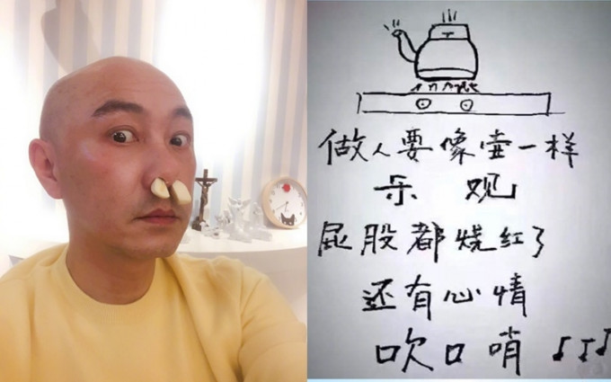 張衛健用蒜塞鼻再喻樂觀心態。