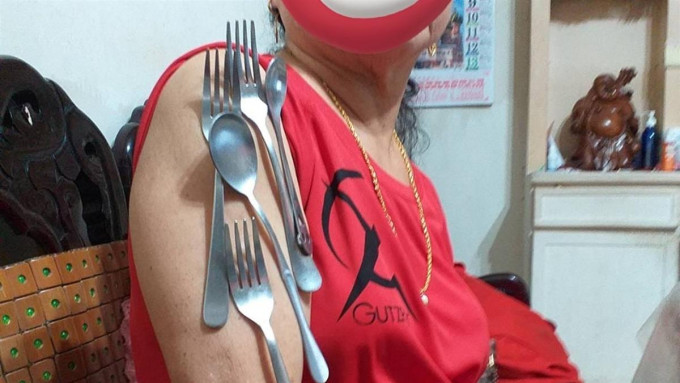 台湾新北市有一名妇人打了莫德纳疫苗后，手臂竟可以吸叉子等餐具。网上图片