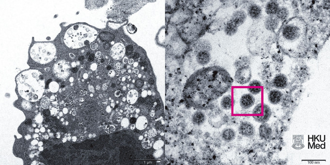 高倍电子显微镜下受感染的Vero E6细胞。照片显示病毒颗粒，其表面呈现皇冠形的刺突蛋白（见红框）。