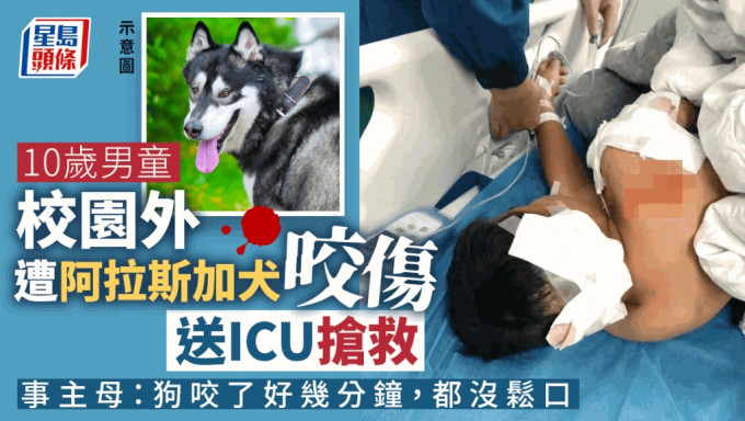 湖南10歲男童遭阿拉斯加犬咬傷 仍在ICU搶救