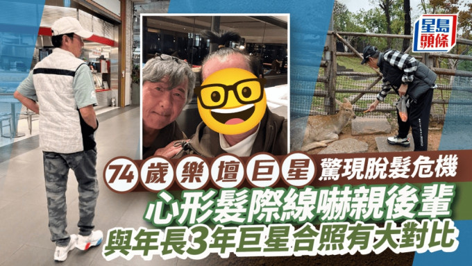 74歲樂壇巨星驚現脫髮危機 心形髮際線嚇親後輩 與年長3年巨星合照有大對比