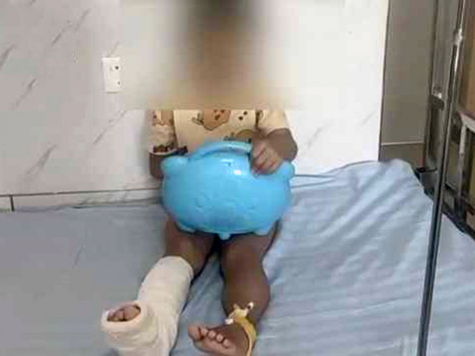 5歲男孩被蚊子叮後狂抓，致皮膚紅腫發紫要入院動手術。
