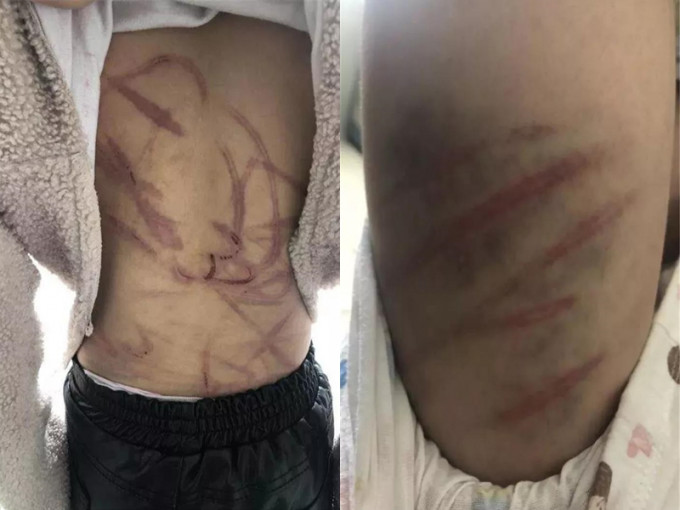 扬州一位市民向内地传媒报料称，当地一名10岁女童遭遇父母家暴。 网上图片