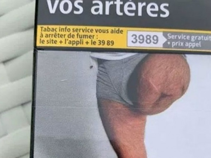 法國一名60歲男子赫然在香煙包裝上，看到自己被截除其中一隻腳的照片。　網圖