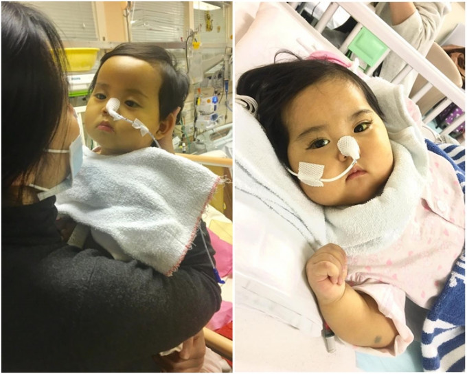 女嬰小予恩去年12月在瑪麗醫院接受肝腸脗合手術後，心跳一度停頓6分鐘。資料圖片