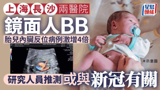 鏡面人BB ︱疑與新冠有關？ 上海長沙兩醫院胎兒內臟反位增4倍