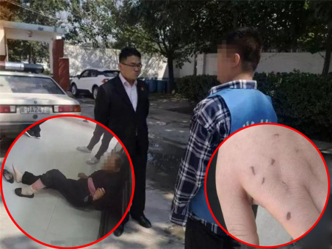 陝西男子欠朋友18萬不還，其母向執法人員動手，一名女法警的手被抓得傷痕纍纍，雙雙被捕。（網圖）