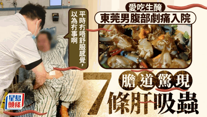 东莞男爱吃生腌海鲜，胆道内惊现7条肝吸虫且大量虫卵。