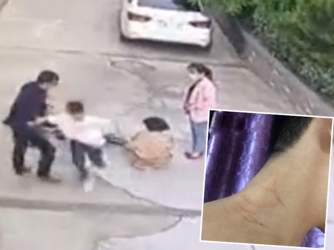 不滿妻子被撞倒暴打兩名小孩，陝西教師被停職。(網圖)