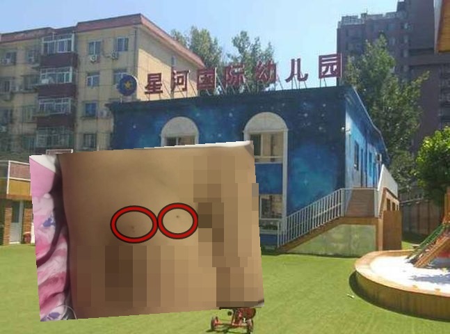 北京一間幼稚園疑發生虐童事件。網圖