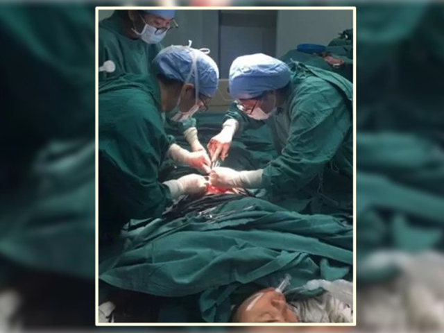 為免胎死腹中，李婦決定接受醫生建議，在沒有麻醉的情況下剖腹取出嬰兒。 網上圖片