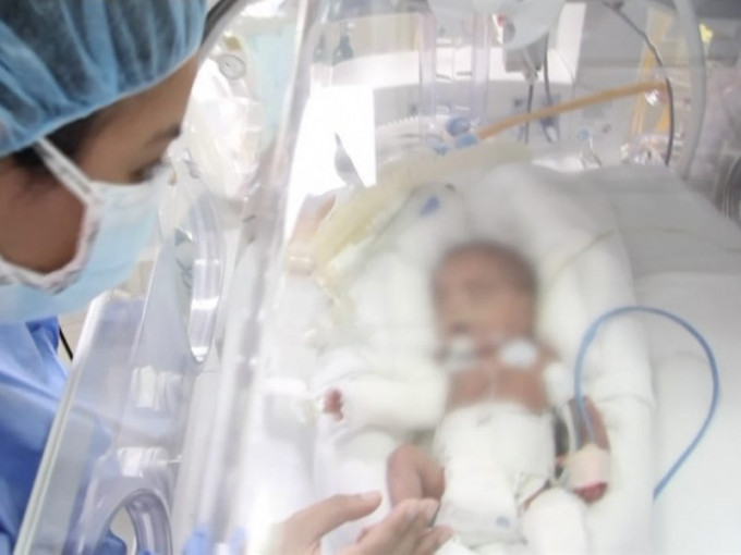 秘鲁一名23周只有580克早产婴儿成功克服新冠肺炎。(网图)