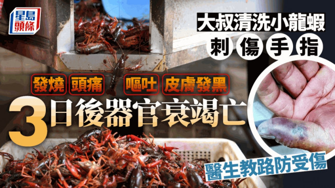 杭州大叔洗小龙虾手指被刺伤，被维隆气单胞菌攻击，3天后多脏器衰竭亡。