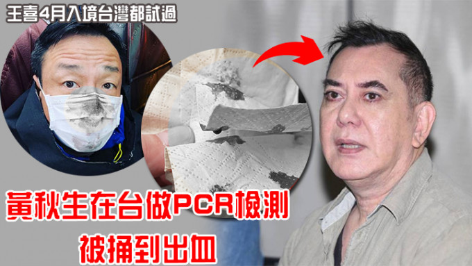 继王喜后，再有港星在台湾做PCR检测遇到出血情况。