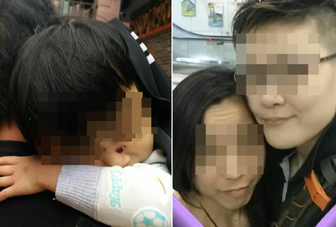 根據女童家人提供的照片可見，女童被接回時陷入半昏迷狀態，她面部有傷痕。