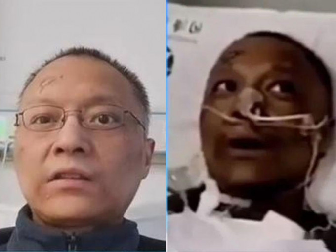 武汉两名感染新冠肺炎的医生面容变黑，引发关注，其中一名医生康复不少更接受采访，皮革颜色明显改善。(网图)