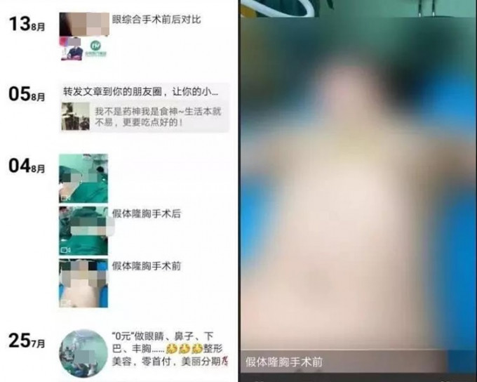 山东一间整容诊所竟于网上播放顾客的隆胸手术片段。网图