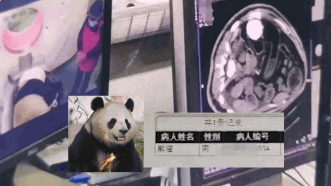 患者「熊貓」照CT惹關注 「七七」突發腸梗阻要做手術