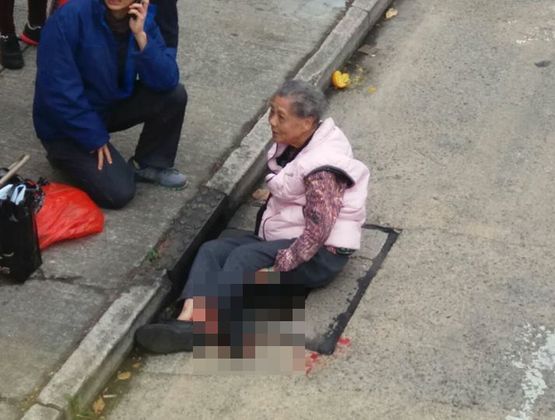 老妇被巴士撞断脚待救。 网图