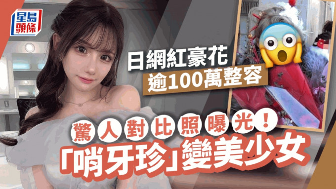 日网红花逾100万整容！惊人对比照曝光   哨牙单眼皮变甜美少女