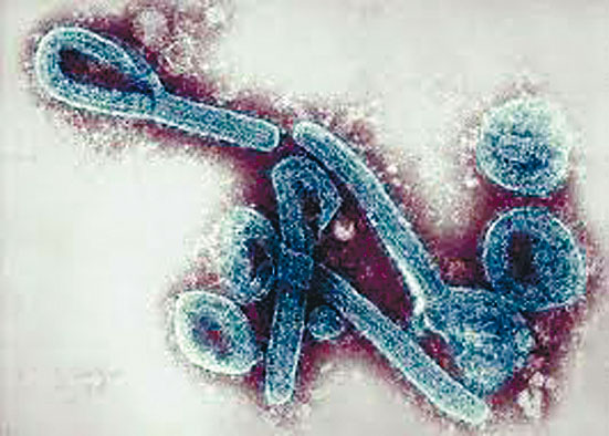 馬爾堡病毒最先在德國馬爾堡發現。