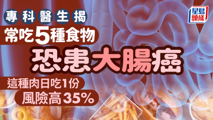 大腸癌丨醫生揭常吃5種食物易患大腸癌 這種肉日吃1份風險高35%