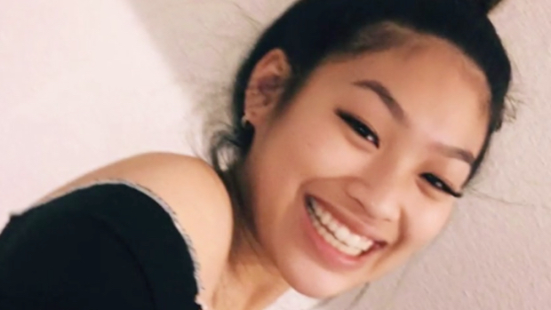 18岁女子艾玛琳（Emmalyn Nguyen）进行丰胸手术期间失去知觉变成植物人，随后死亡。