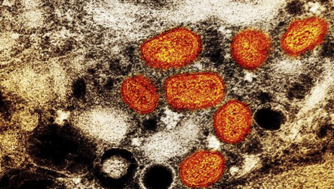 廣州發現2宗猴痘病例 。