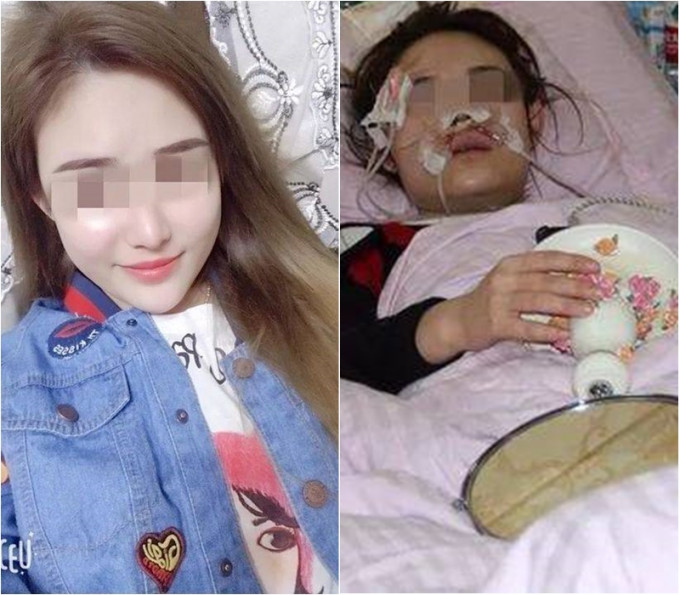 天津25岁女子摸流浪狗惨遭咬脸 。网上图片