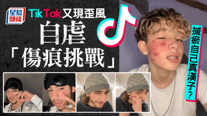 TikTok又现歪风，近日在法国掀起「伤痕挑战」自虐风潮。 网上图片