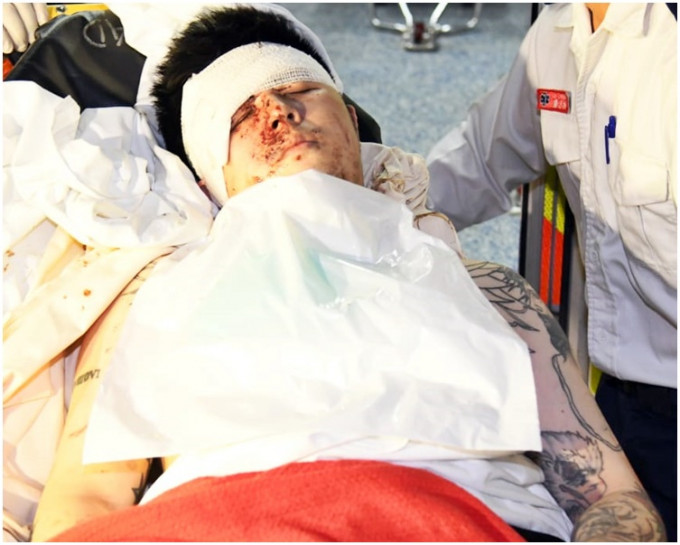 事主眼角受傷，清醒被送往伊利沙伯醫院治理。