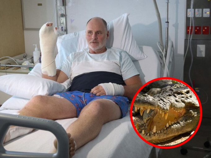 Dickmann手脚的皮肤在与鳄鱼缠斗过程中撕开。现时在凯恩斯医院接受治疗。网图