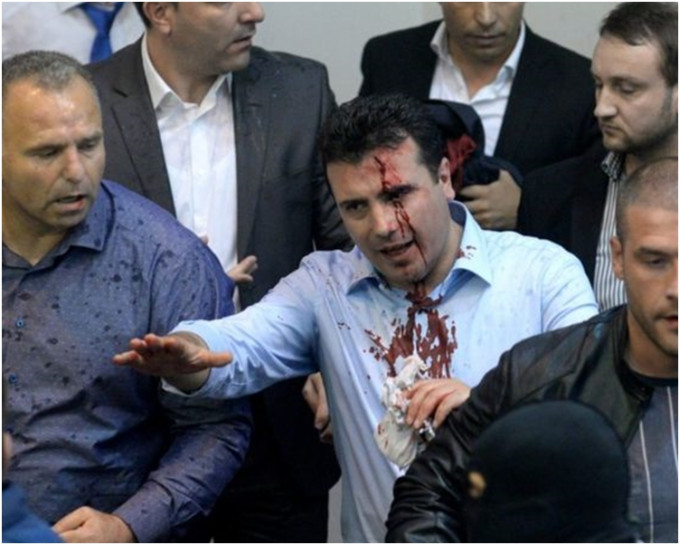马其顿社会民主党党魁扎伊夫，在冲突中受伤，血流披面，要被送往医院治疗。网图