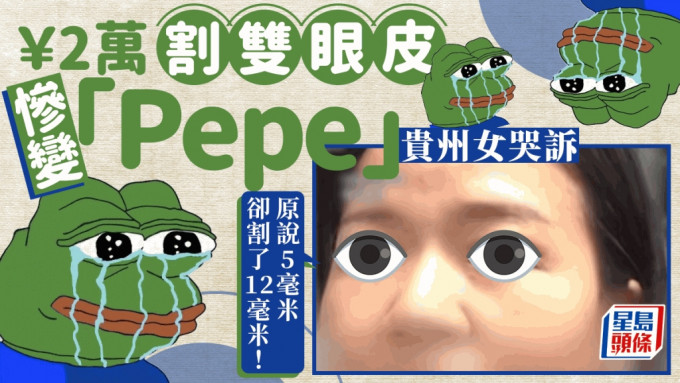 整容变毁容｜贵州女斥2万割双眼皮 惨变「Pepe蛙」