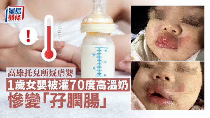女婴的唇部红肿起水泡。fb