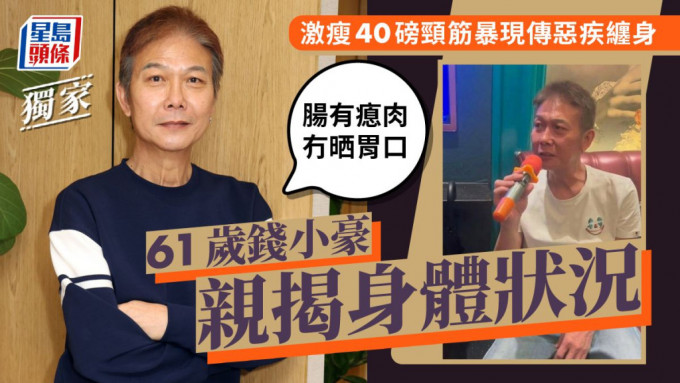 61岁钱小豪亲揭身体状况：肠有瘜肉冇晒胃口  激瘦40磅颈筋暴现传恶疾缠身。