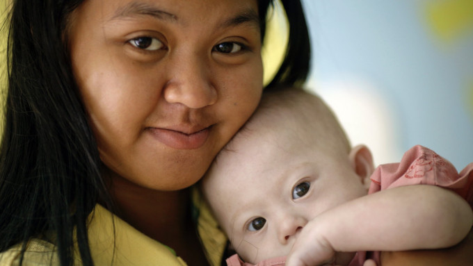 2015年一名泰国女子替澳洲夫妇代孕龙凤胎，该对夫妇遗弃患有唐氏综合症的男婴，引发轩然大波。 路透社资料图