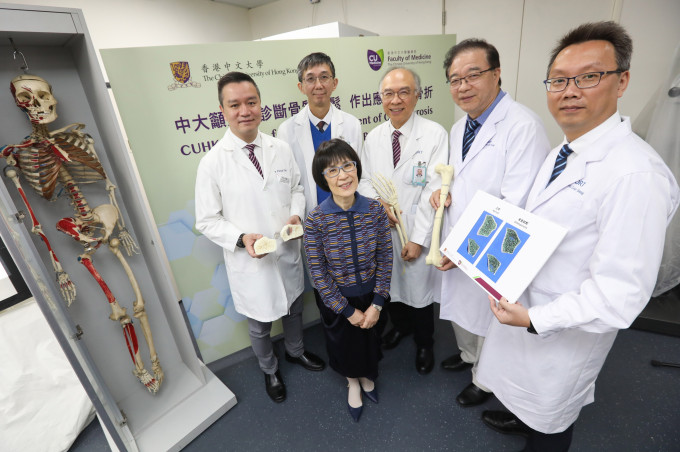 中大醫學院訂立亞洲首個「三維骨質量標準值」。