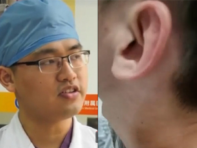 主诊医生马跃（左）扯开患者领口，发现赵先生颈部两侧还有刮痧留下的淡淡红印。（网图）