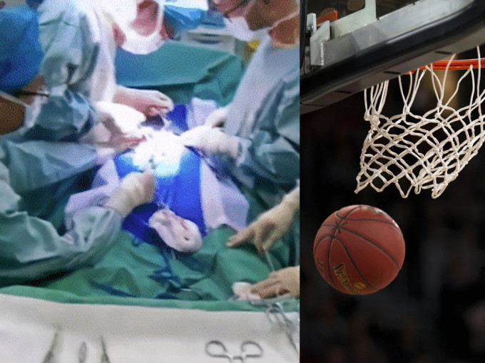 男童打篮球摔倒致睾丸扭转，拒做手术翌日坏死须切除一边。（网图）