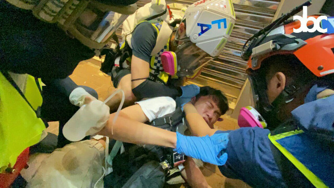 一名急救义工在铜锣湾被催泪弹灼伤后背。城市广播图片
