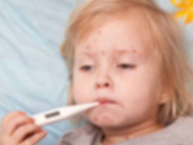 菲律宾爆发麻疹疫情。网图