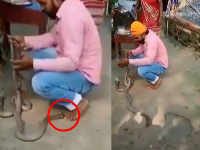 印度一名弄蛇人被毒蛇咬伤脚趾，未能及时注射血清死亡。网上片段截图