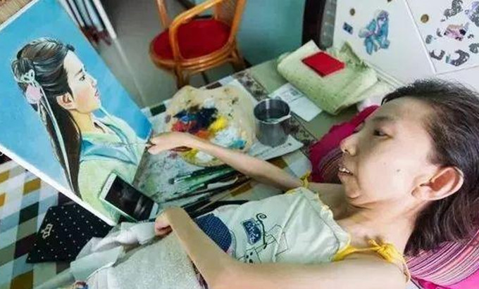 来自山西的张俊莉在6岁不幸患病，8岁开始行动不便，整整卧牀37年。网图