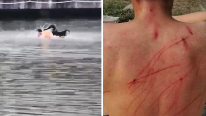 一名男大學生日前在湖中遊泳時遭黑天鵝襲擊，引發熱議。
