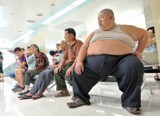 肥胖患者。新华社图片