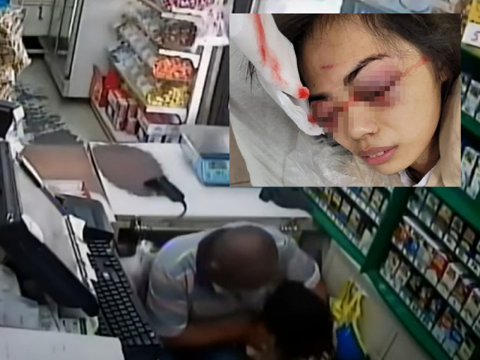 屏東女店員遭精神病漢施襲挖眼，嚴重受傷。 （網上圖片）