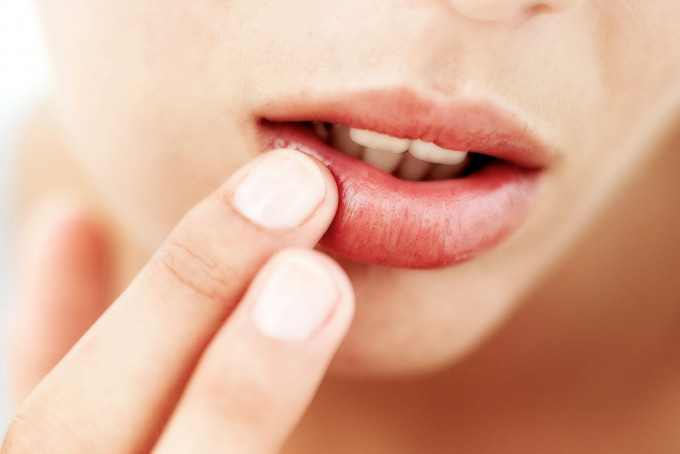 如察觉嘴唇状态有严重异常，应及早求医。网图