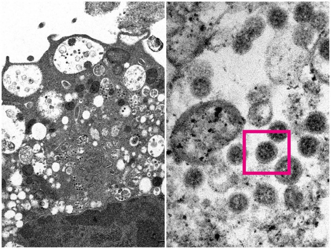 香港大學醫學院發布電子顯微鏡下新冠病毒Omicron變異株的面貌。