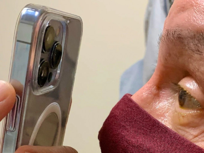 美国有医生声称利用iPhone 13 Pro拍摄病人眼睛情况，有助跟进治疗。 网上图片